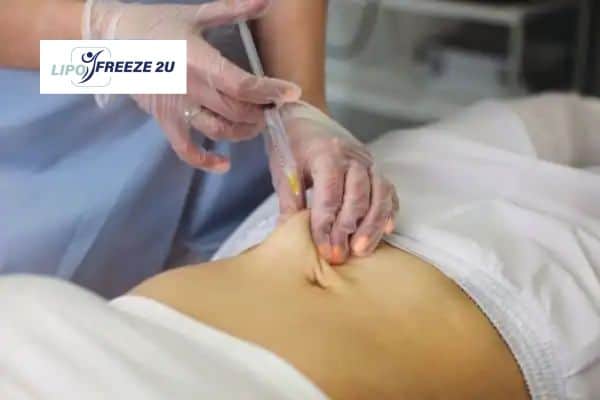 Fat Dissolving Injections Runcorn & Weight loss medication
