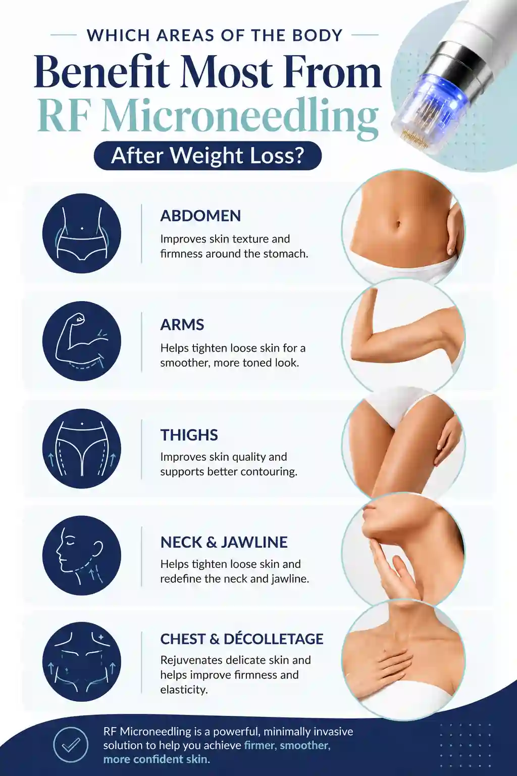 Which Areas of the Body Benefit Most From RF Microneedling After Weight Loss Runcorn