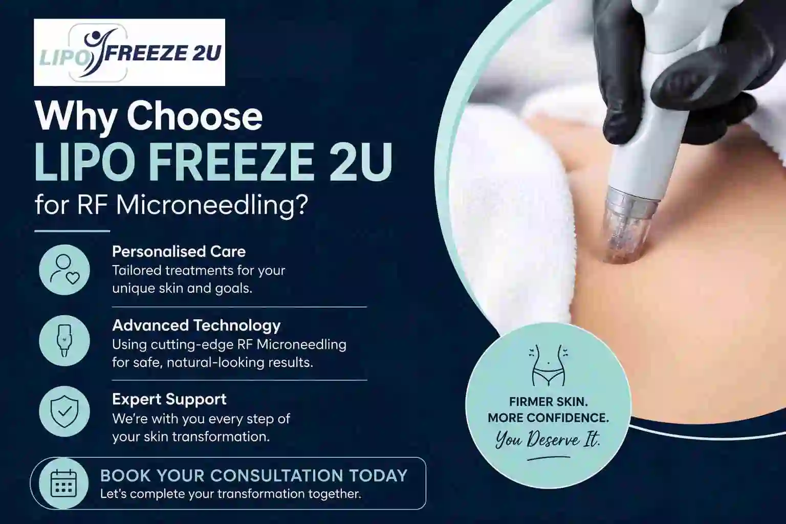 Why Choose LIPO FREEZE 2U for RF Microneedling Runcorn?